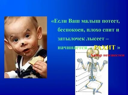 Почему ребенок потеет во сне 1 год