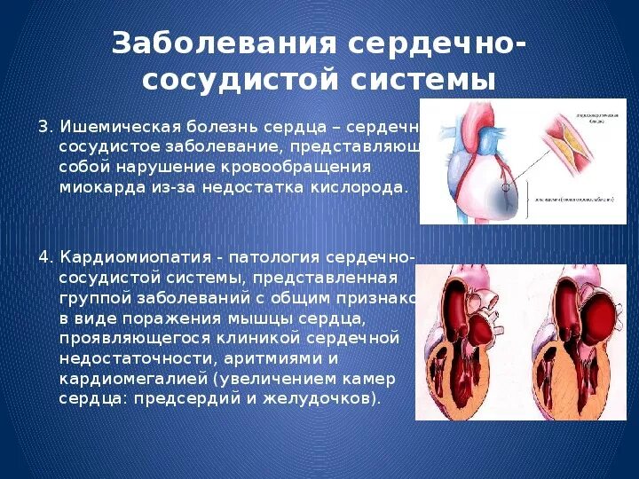 Болезни сердечно-сосудистой системы. Симптомы сердечно сосудистых заболеваний. Болезни органов кровообращения. Основные заболевания сердечно-сосудистой системы. Причины болезней системы кровообращения