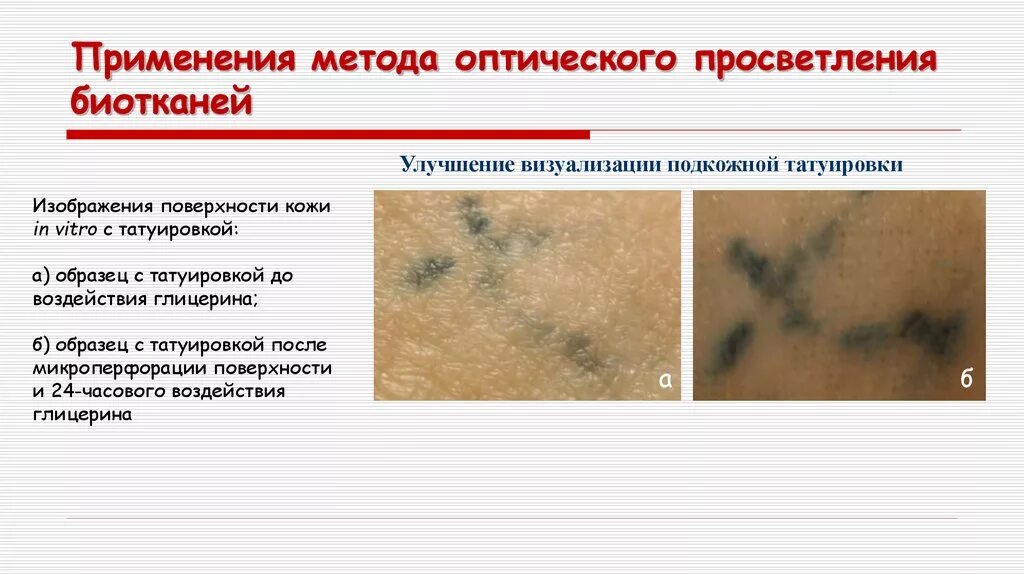 После микро