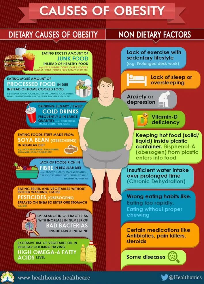 Causes of obesity. Articles about obesity. Physical inactivity. Obesity reasons. Childhood obesity.