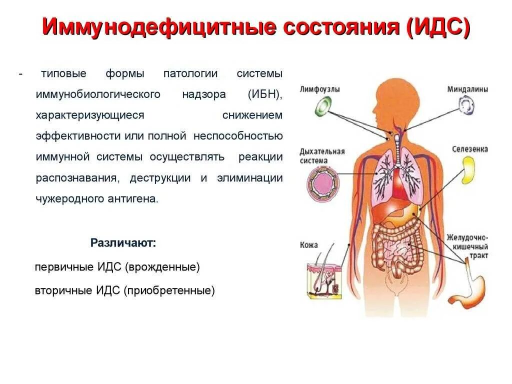 Иммунодефицитные состояния. Иммунно дефецитные состояния. Иммунодефицитные состояния (ИДС). Иммунодефицитные состояния у детей классификация.