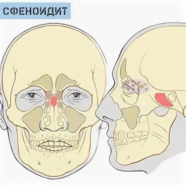 Клиновидная носовая пазуха. Клиническая анатомия носа. Носе клиновидный. Клиновидная пазуха носа анатомия. Носе клиновидный.