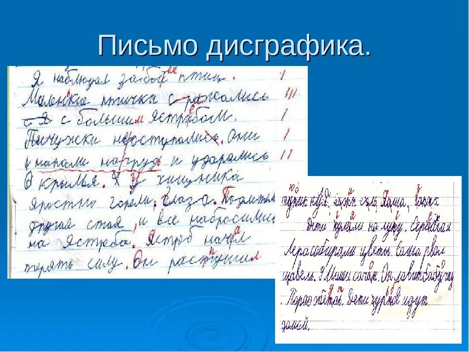 Дисграфия русский язык. Дисграфия. Примеры детей с дисграфией. Письменные работы детей с дисграфией. Дисграфия и дислексия.