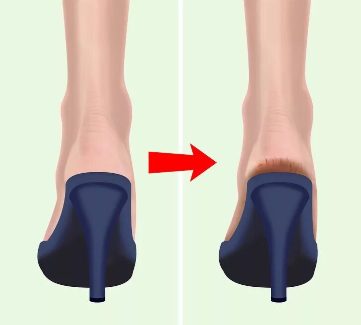 Обувь с глубокой пяткой. Что уходит в пятки