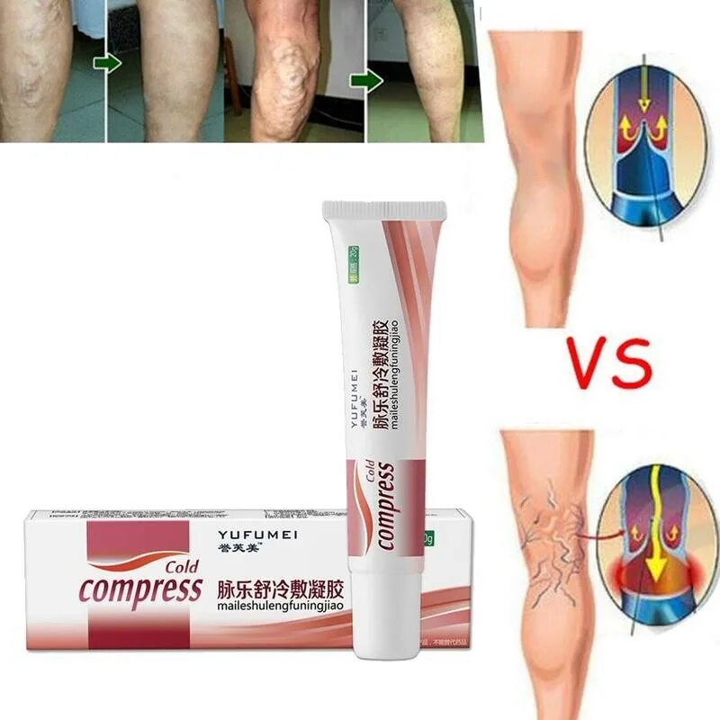 эффективные мази от варикоза. эффективные мази от варикоза. мазь от варикозного расширения вен на ногах. эффективные мази от варикоза. крем от расширение вен.