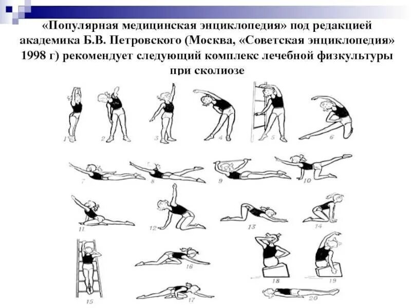 Упражнения для позвоночника при сколиозе. Лечебная физическая культура при сколиозе 2 степени. Комплекс упражнений при сколиозе 1 степени у подростка ЛФК. Упражнения ЛФК при сколиозе 2 степени. Упражнения ЛФК для спины при сколиозе 1 степени у детей.