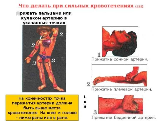 Остановить кровотечение на сонной артерии ответ тест. Артериальное кровотечение. Артерия в артериальном кровотечении. Места артериального кровотечения.