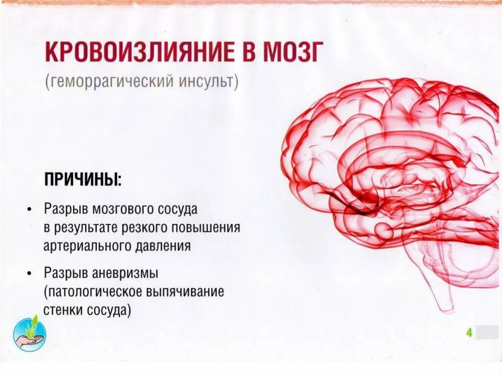 Инсульт 3 степени. Кровоизлияние в мозг симптомы. Кровоизлеяние в Можг причин. Кровоизлияние в мозг это инсульт. Кровоизлияние в мозг причины признаки.