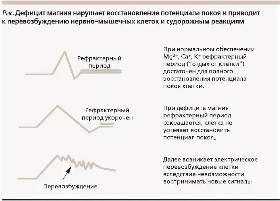 Недостаток магния в организме после 50. При недостатке магния развивается. Дефицит магния симптомы. Судороги при недостатке магния. Дефицит магния симптомы у женщин.