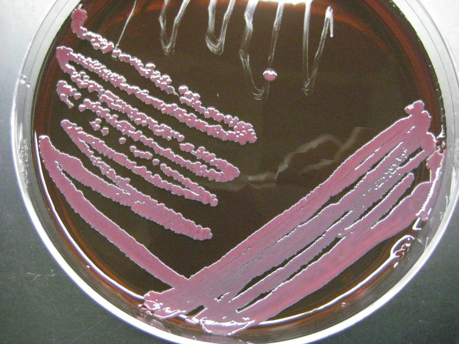 Enterobacter cloacae что это. Энтеробактер cloacae. энтеробактер аэрогенес. энтеробактер на эндо.