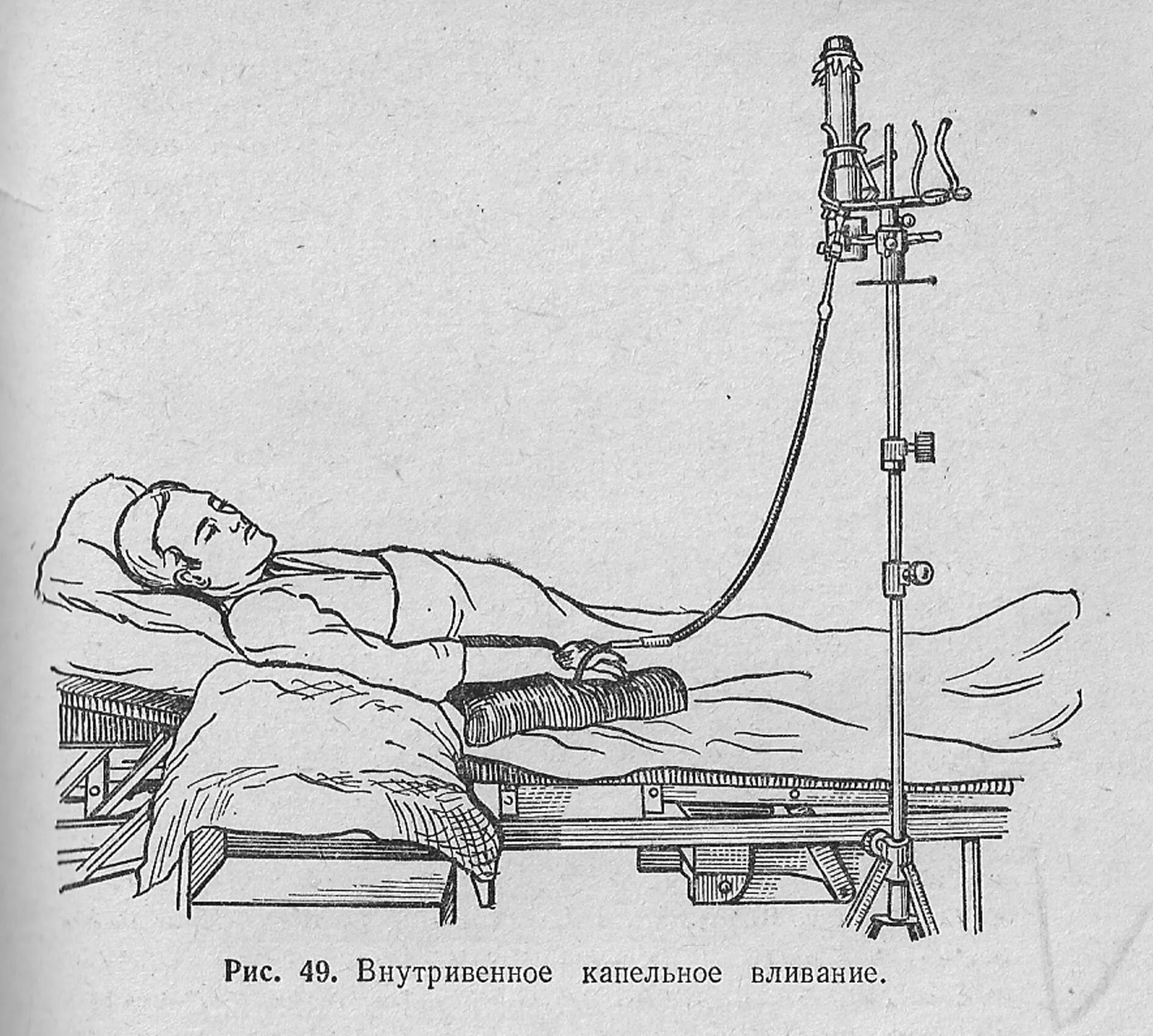 Внутривенно капельно. Система для внутривенного капельного вливания. внутривенное капельное вливание алгоритм. алгоритм введения внутривенного капельного вливания. постановка капельницы для внутривенного вливания.