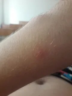 Приметы прыщ на правой