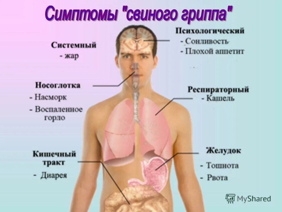 Желудочный грипп у взрослых. Свиной грипп. Презентация на тему свиной грипп. Свиной грипп симптомы.