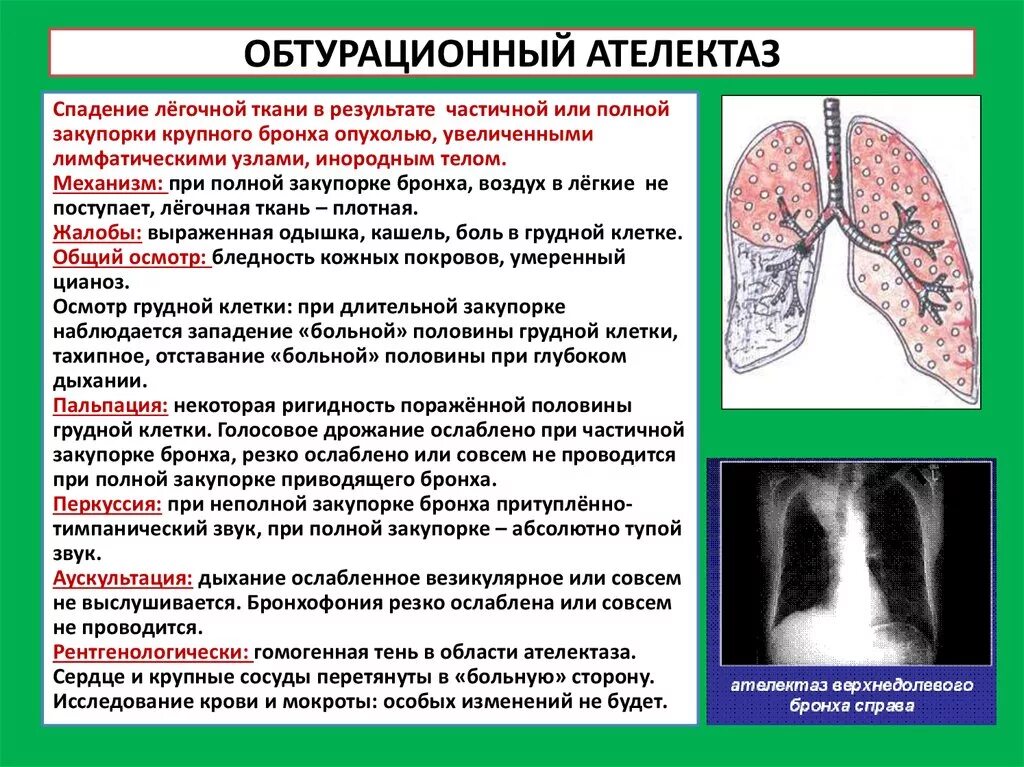 Синдром ателектаза легкого компрессионный. Симптомы обтурационного ателектаза. Синдром ателектаза симптомы. Синдромы компрессионного и обтурационного ателектаза легких. Компрессионный ателектаз легкого