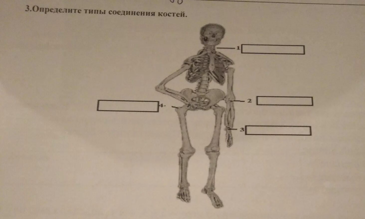 Отличить кость. Определите типы соединения костей. Соединение кости. Определите вид соединения костей.