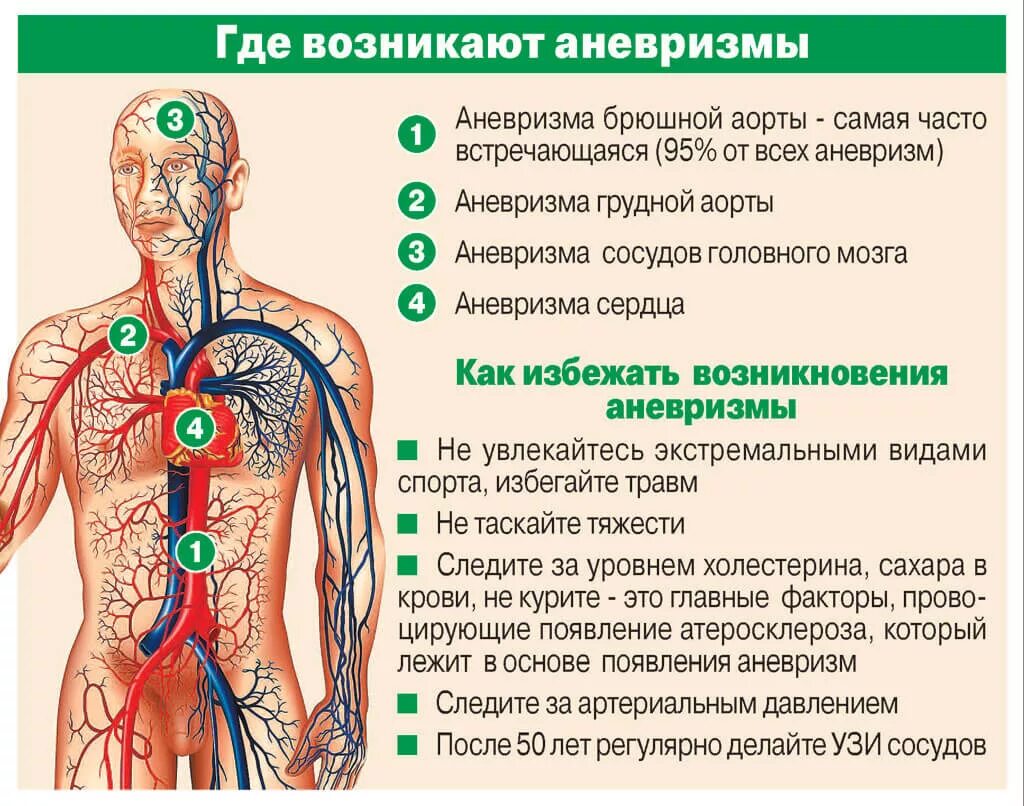 Как понять что проблемы с сосудами