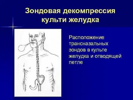 Декомпрессия это