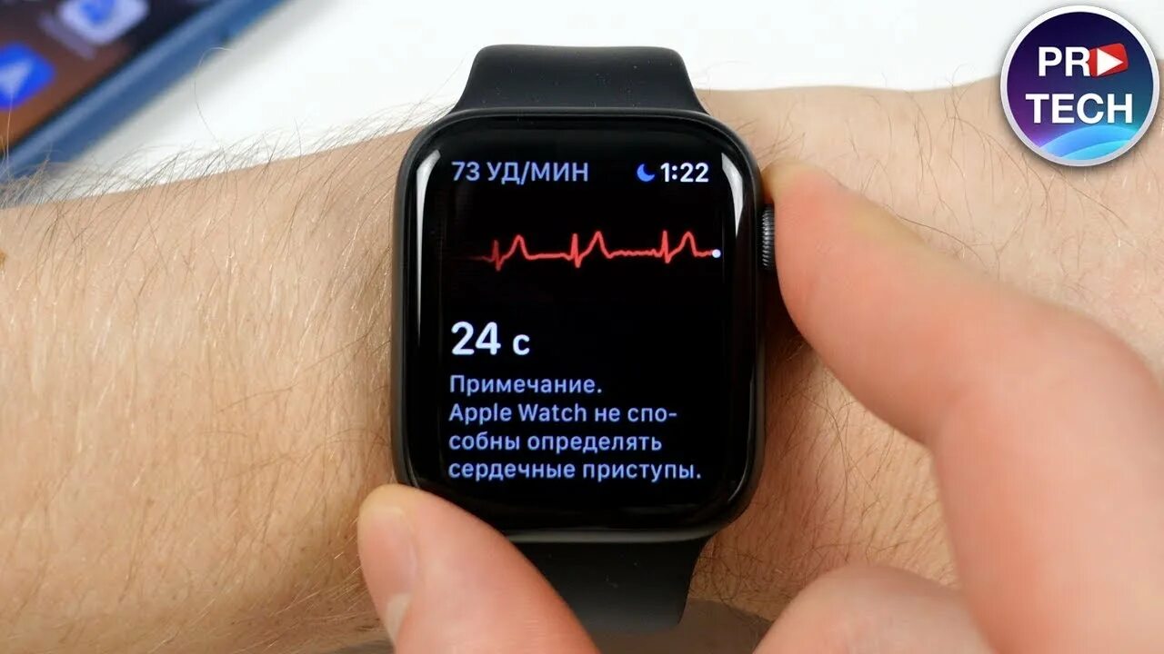 Apple watch измерение давления. ЭКГ на Эппл вотч. ЭКГ на Эппл вотч 6. Смарт часы с ЭКГ. Часы для измерения ЭКГ.