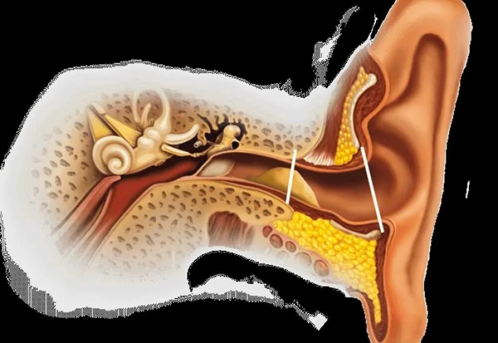 Почему образуются пробки в ушах
