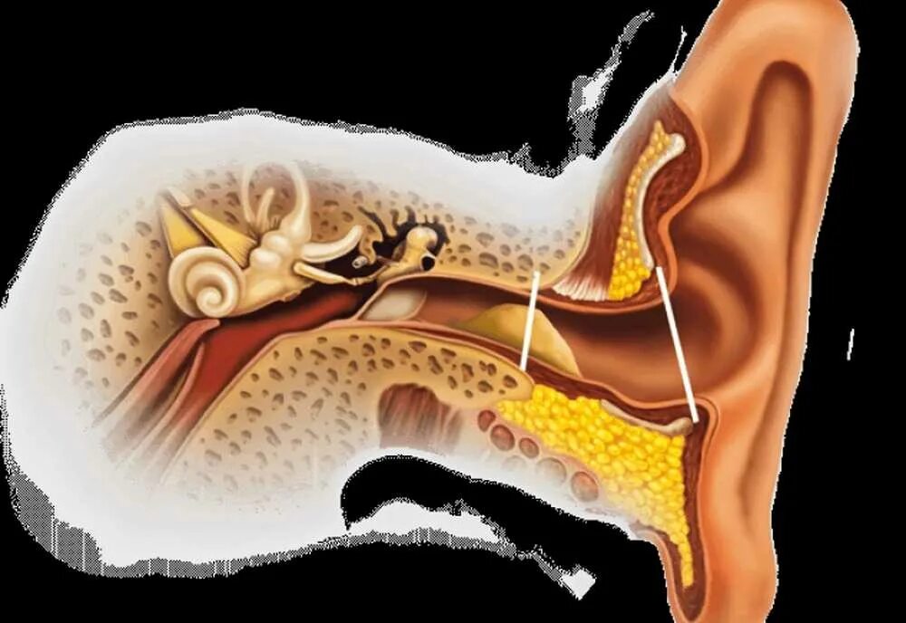 Почему именно ухо. Буллёзный отит барабанная перепонка. Ушная сера в барабанной перепонке. Тубоотит барабанная перепонка. Анатомия уха серная пробка.