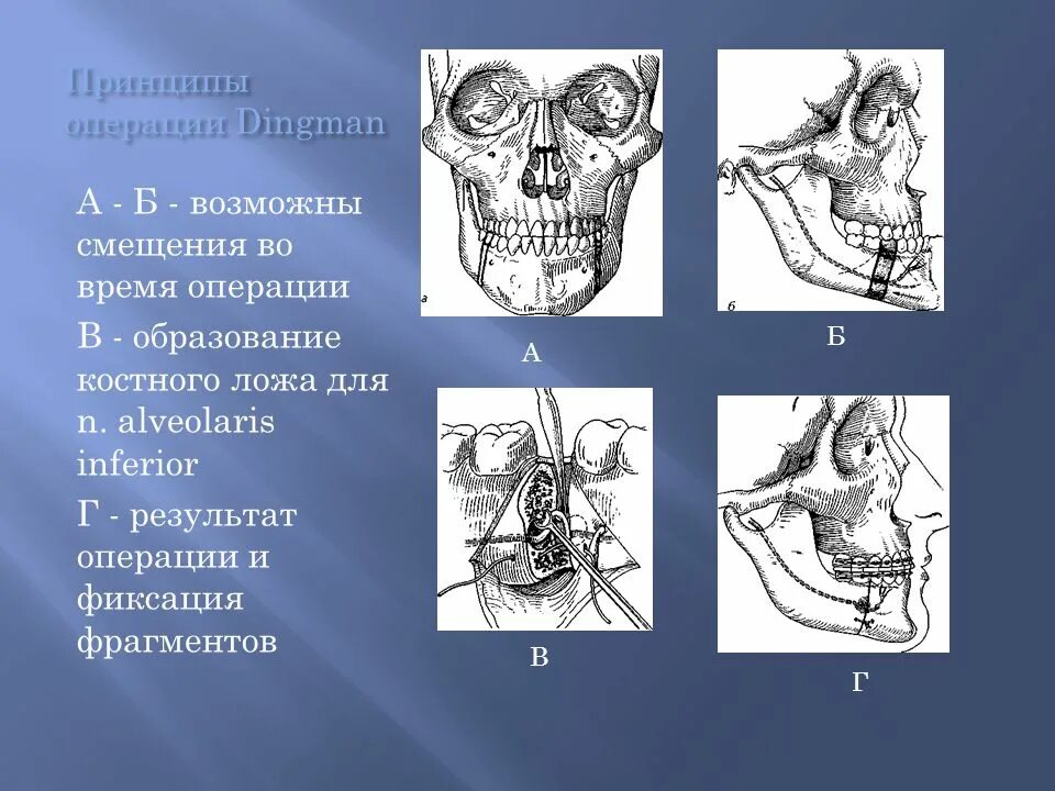 Пороки челюстно лицевой области. Аномалии развития челюстно лицевой области. Врожденных пороков челюстно-лицевой области (ЧЛО),. Дефекты нижней челюсти классификация.