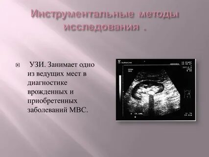 Виды узи