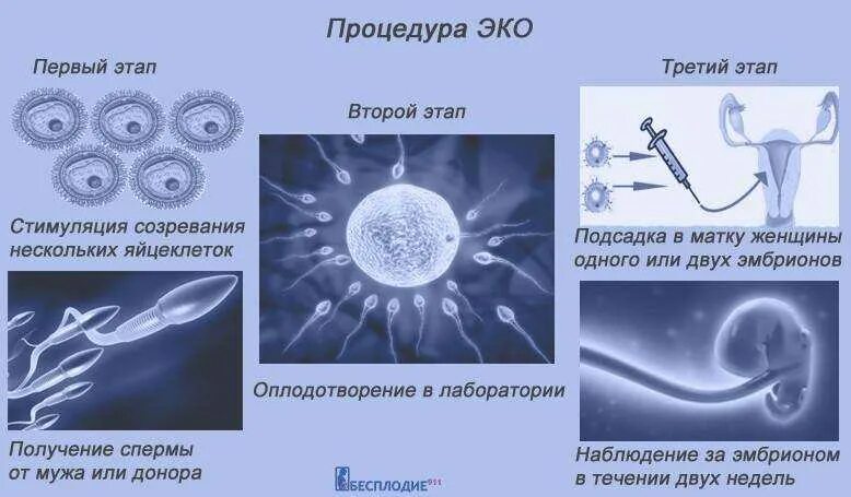 Схема экстракорпорального оплодотворения. Оплодотворение яйцеклетки ИКСИ. Эко метод оплодотворения. Эко оплодотворение яйцеклетки в пробирке. Этапы эко по дням