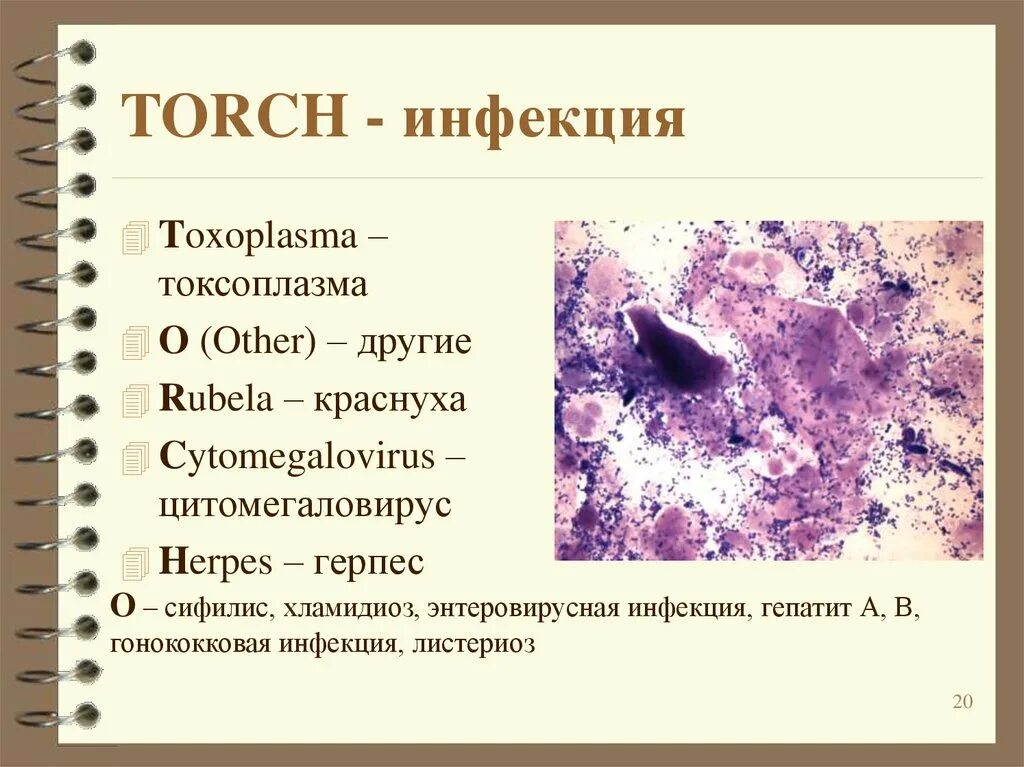 Torch комплекс. Торч инфекции. Торч инфекции презентация. Возбудители Torch инфекции. Торч инфекции список.