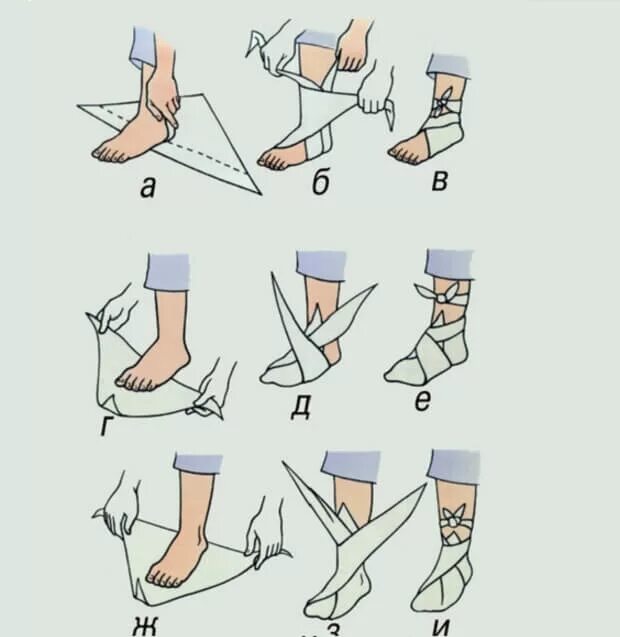 Наложение эластичного бинта на конечность. Наложение косыночной повязки. Наложение косыночной повязки на стопу. Косыночная повязка на стопу алгоритм. Наложение косыночной повязки на стопу алгоритм.