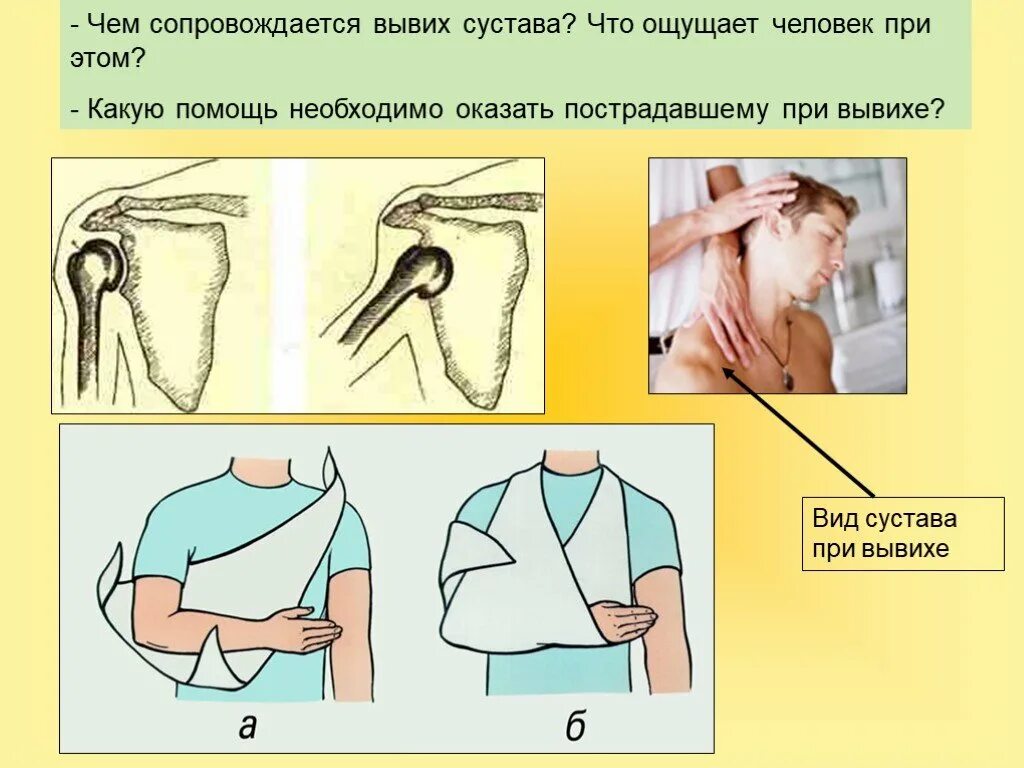 Алгоритм оказания неотложной помощи при вывихе плеча. Первая помощь при вывихе сустава. Чем сопровождается вывих сустава. Оказание первой помощи при вывихе плечевого сустава.