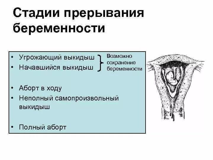 Беременность после самопроизвольного. Клинические стадии самопроизвольного аборта. Стадии выкидыша таблица самопроизвольного. Стадии самопроизвольного выкидыша. Стадии прерывания беременности.