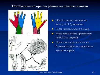 Рана пальцев кисти код