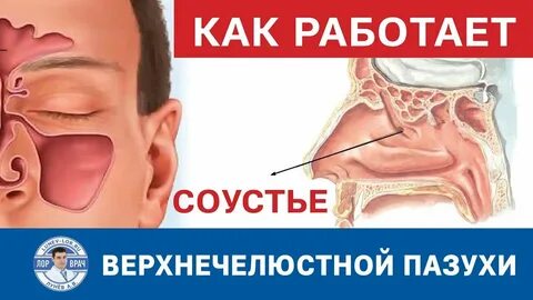 Соустье