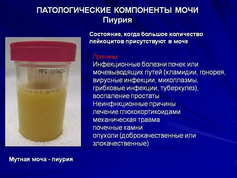 Моча темная при каких болезнях