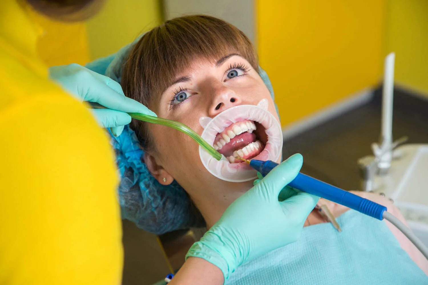 Чистка зубов казань. Стоматологическая чистка зубов. Гигиена полости рта в стоматологии.