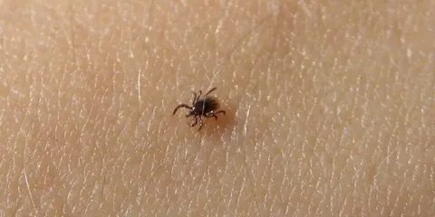 К чему снятся клещи на теле