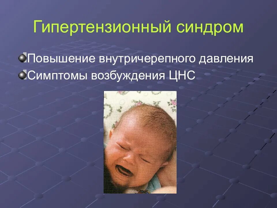Внутричерепное давление у ребенка симптомы. Гипертензионный синдром. гипотензиононный синдром. гипертензионно ликворный синдром. гипертензионный синдром у детей симптомы.