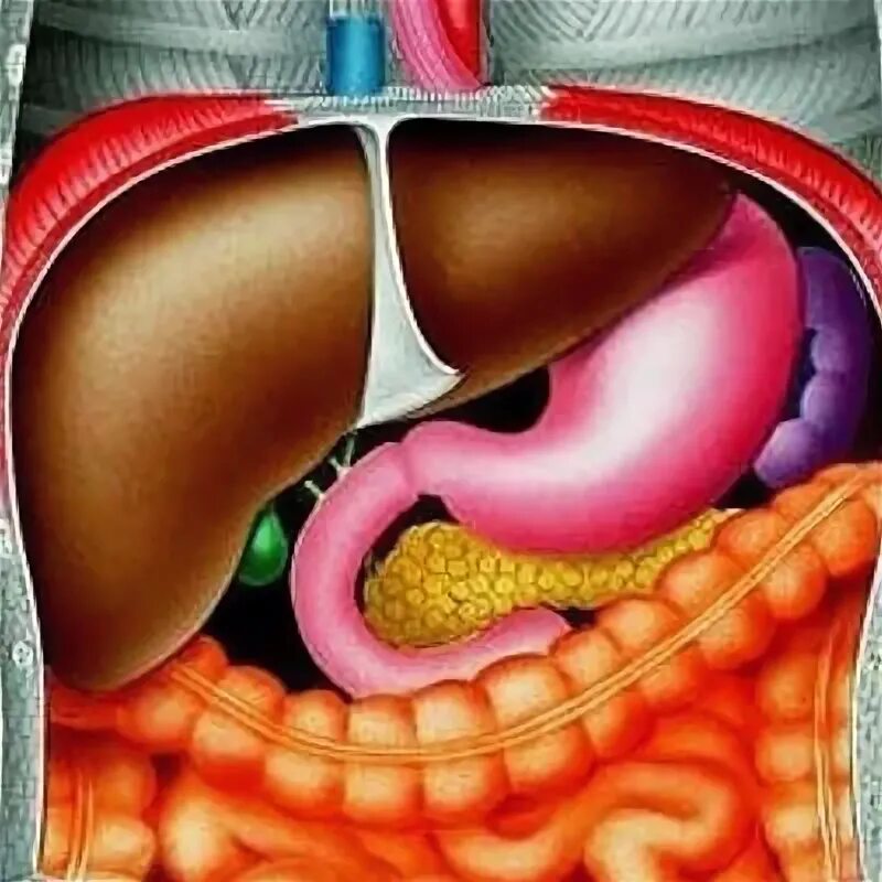 жировая инфильтрация печени. жировой гепатоз развивается при. ожирение печени гепатоз печени. жировой гепатоз печени лечится. гепатоптоз печени.