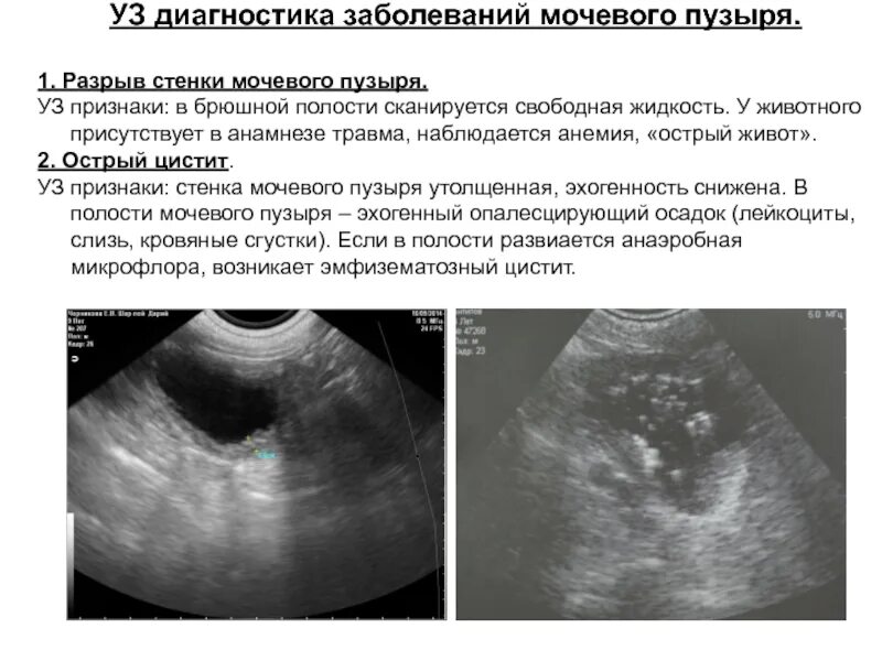 Мочевой пузырь после удаления матки