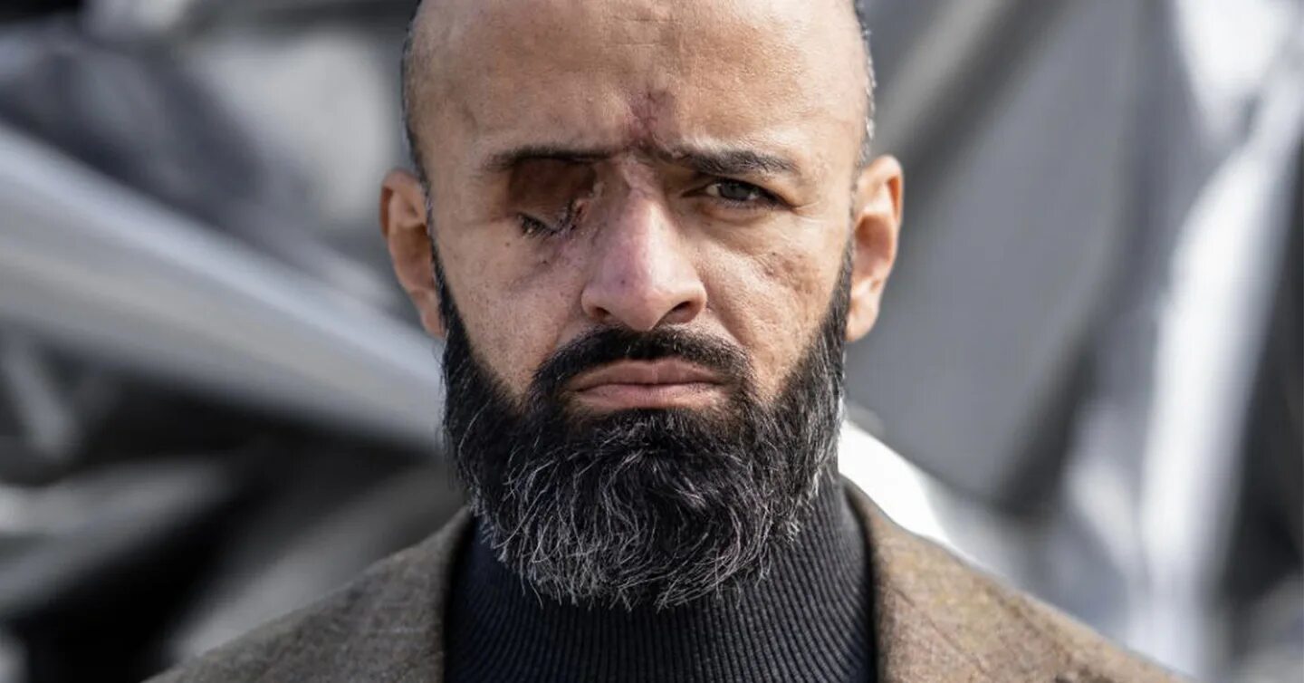 Маси найем. Зам министра найема. Маси найем адвокат. Маси найем ранен. Маси найем одноглазый.