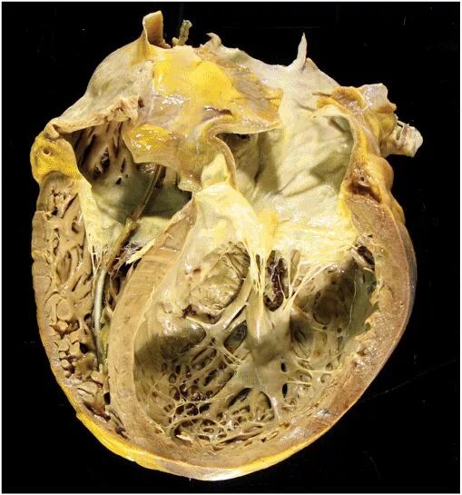 Noise Issues Prevailing in Various Types of Medical Images - Biomedical and Phar