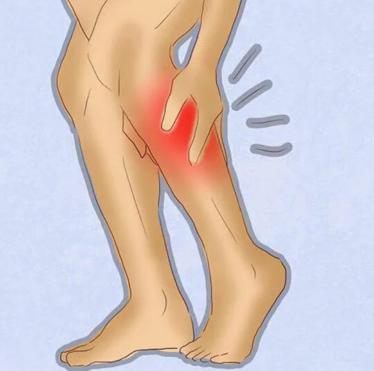 Почему икру сводит судорогой ночью. Судорога икроножной мышцы. Судороги в ногах икроножные мышцы. Скдорга тероножной мышчы. Свело икроножную мышцу.