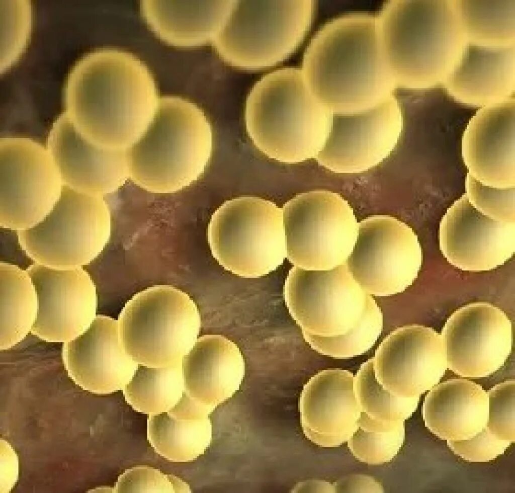 Стафилококкус ауреус. Стафилококки (s. aureus),. S. aureus золотистый стафилококк. 1 staphylococcus aureus