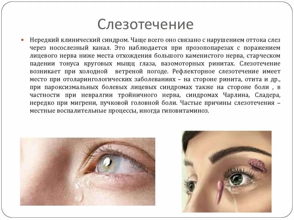 Почему постоянно слезы. Причины слезотечения глаза. Причина слезятся глаза у человека. Слезоточивость глаз причины.