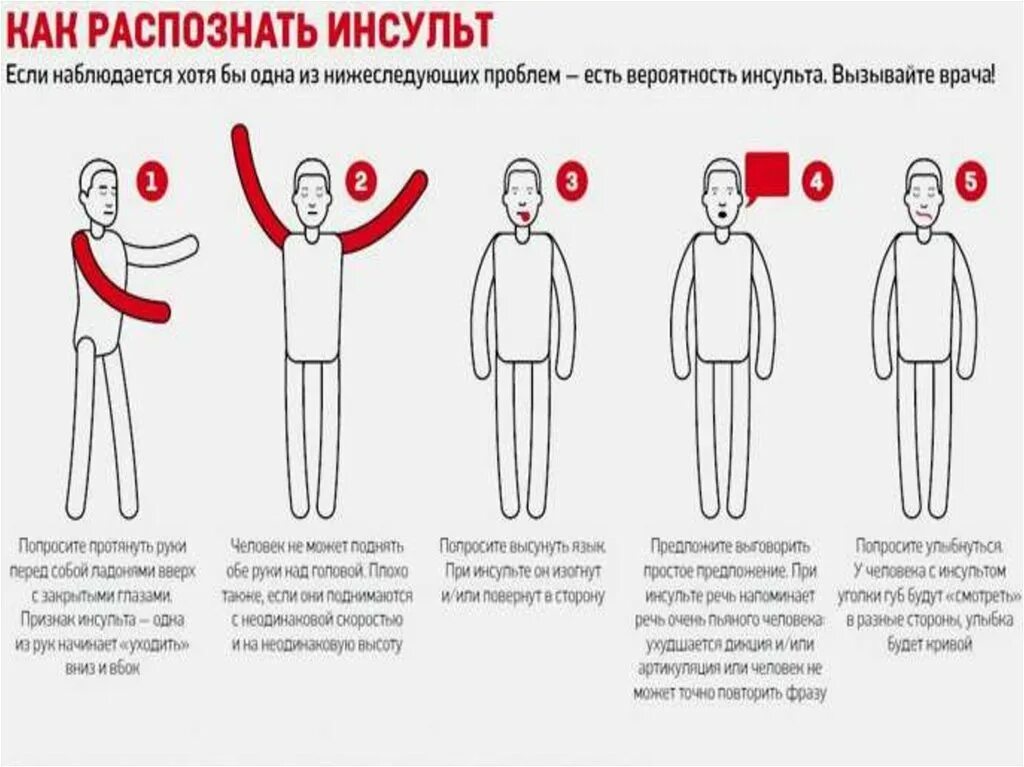 Парализовало левую сторону после инсульта. Инсульт левая рука. Руки при инсульте. Поднятие рук при инсульте.