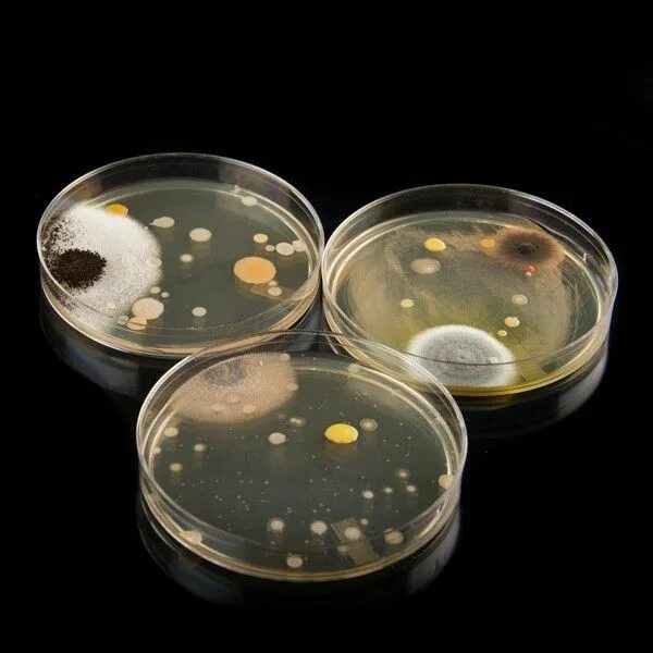 Биотехнология чашки петри с микроорганизмами. Чашка петри чувствительность к антибиотикам. Агар агар в чашке петри. Колонии бактерий в чашке петри. Чашка петри с субстратом.
