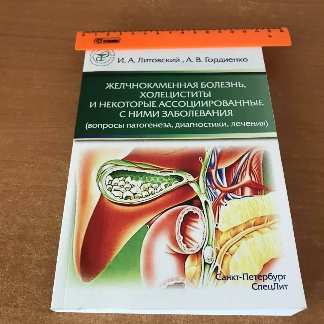 Жкб холецистит мкб. Желчнокаменная болезнь холецистит. Торпидная форма желчнокаменной болезни. Желчнокаменная болезнь Гордиенко. Дифференциация ЖКБ И холецистита.