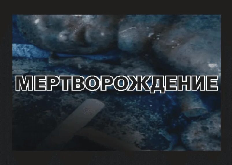 Мертворождение причины. Мертворождение с пачки сигарет. мертворождение от курения. страшные картинки на сигаретах. предупреждения на пачках сигарет.
