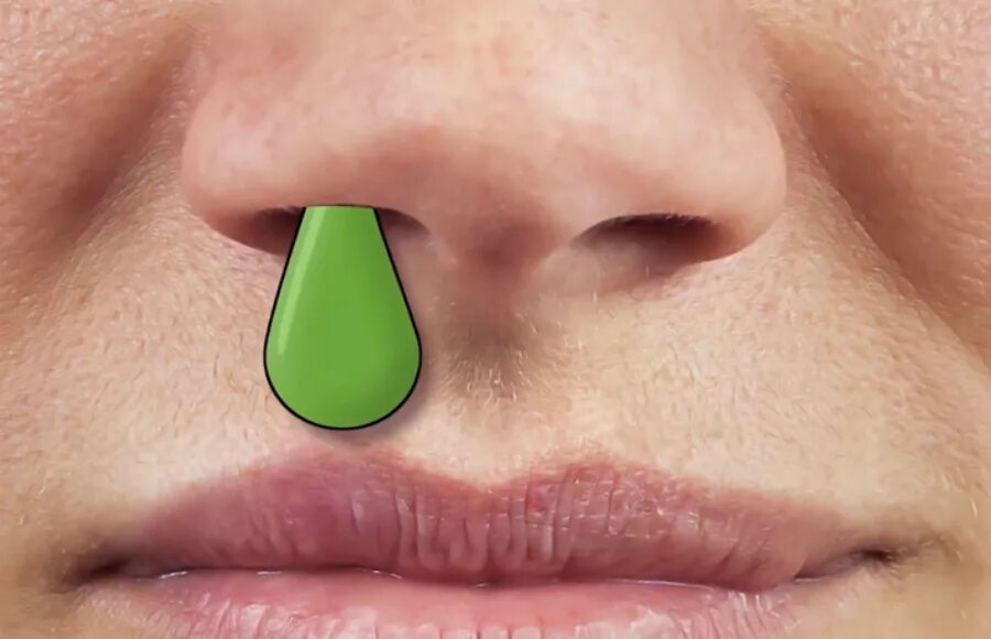 Слизь в носу у взрослых. Слизь в носу у взрослых. Гнойный гайморит слизь. Слизь в носу у взрослых. Слизь в носу у взрослых.