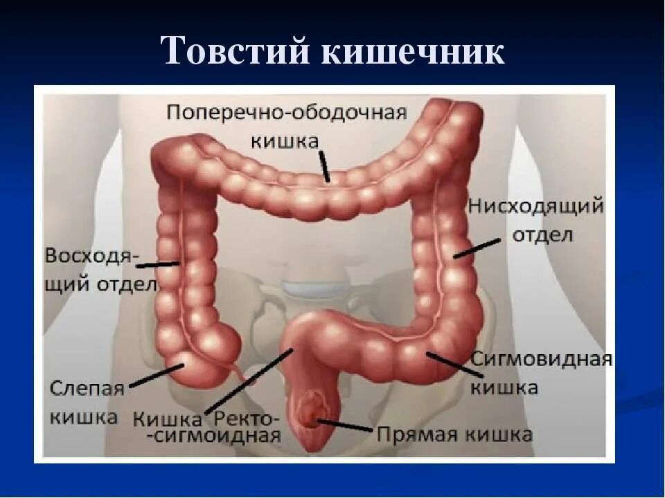 Сигмовидная кишка где находится и симптомы. Сигмовидная кишка где находится и симптомы
